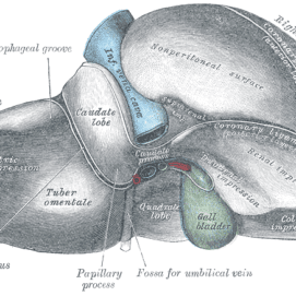 Rare Genetic Condition May Also Increase Risk of Severe Liver Disease in Cystic Fibrosis