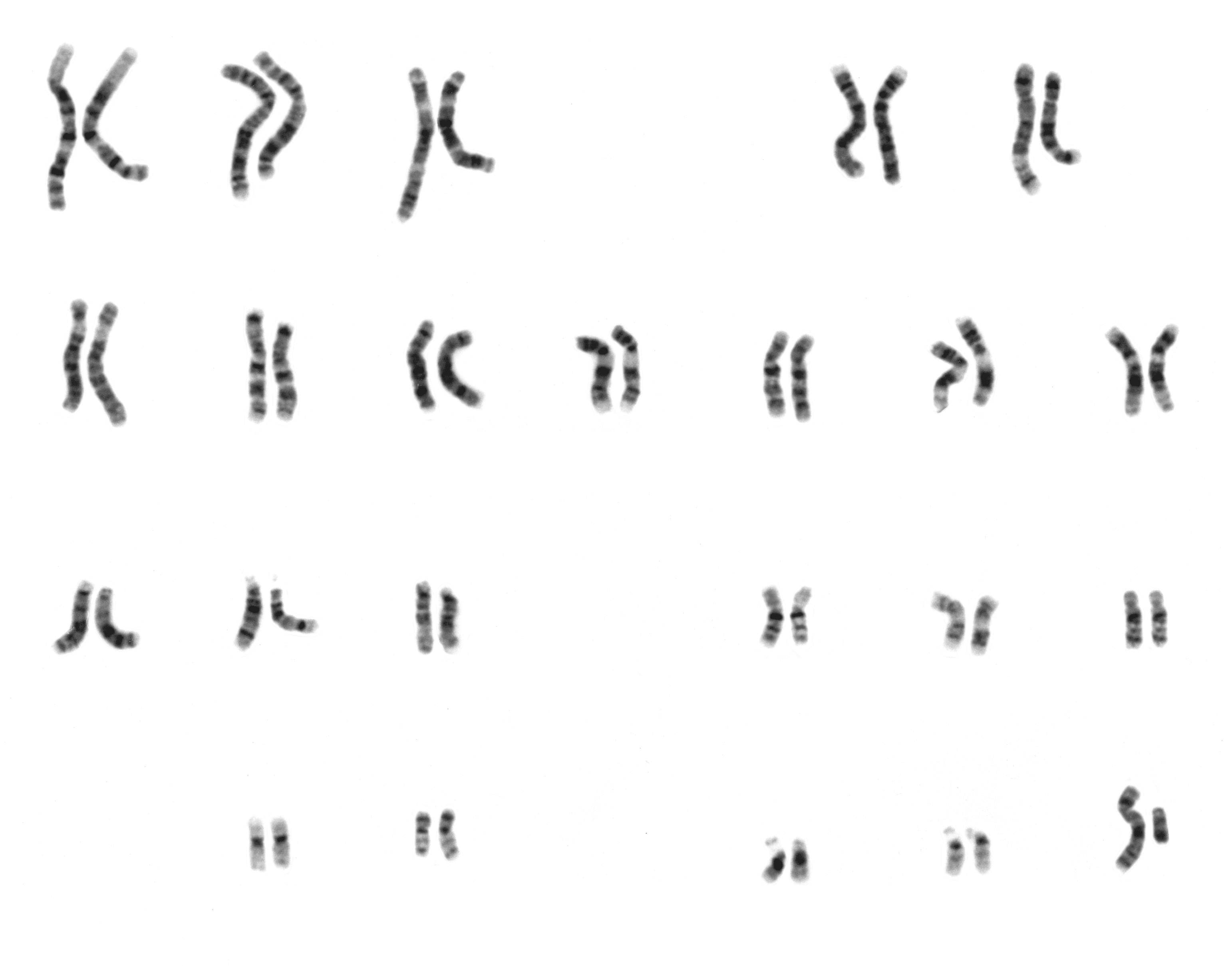 The Disappearing Y: New Study Uncovers the History and Future of the Y Chromosome