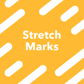 23andMe’s New Report on Stretch Marks