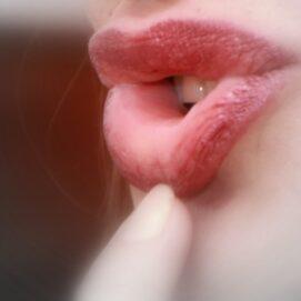 Why Do People Stutter? Genetics Holds Some Clues