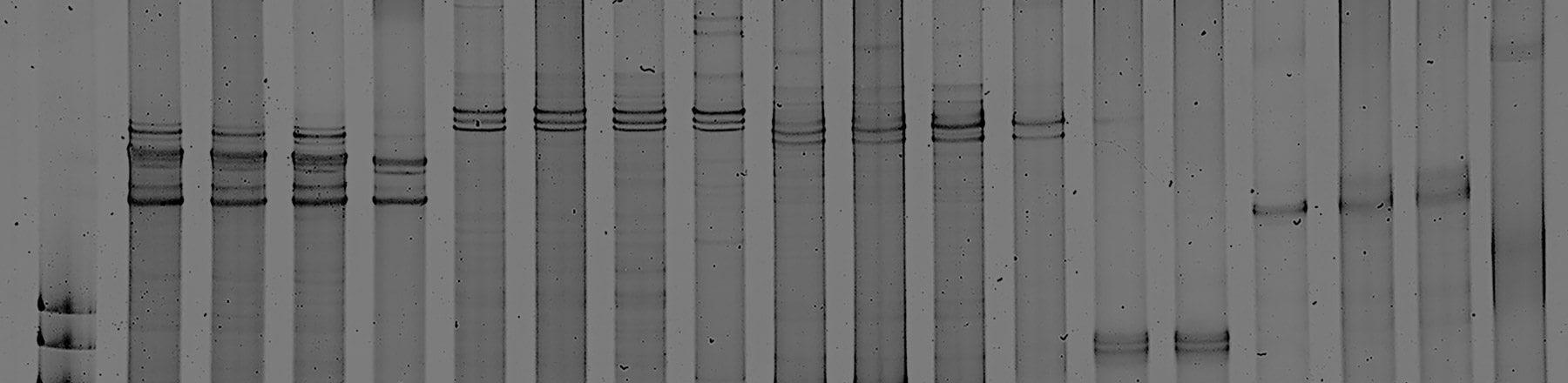 The Gene: An Intimate History