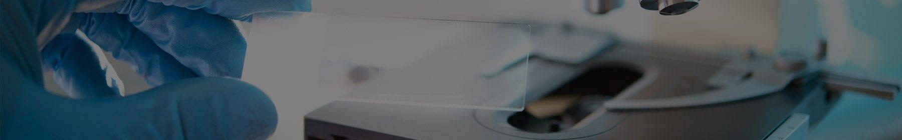 The role of genetics in male-pattern baldness