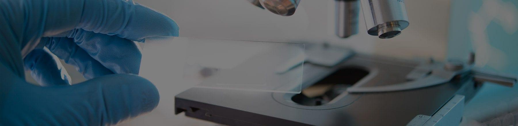 Genetic Variations May Increase Risk Of Prostate Cancer In Japanese Men