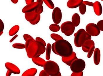 A Stroke Survivor Wants to Raise Awareness for Other Women